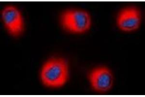 Immunofluorescent analysis of STEAP2 staining in HEK293T cells. (STEAP2 Antikörper  (C-Term))