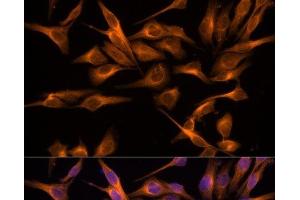 Immunofluorescence analysis of HeLa cells using UNG Polyclonal Antibody at dilution of 1:100. (UNG Antikörper)