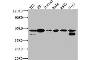 Western Blot Positive WB detected in: NIH/3T3 whole cell lysate, 293 whole cell lysate, Jurkat whole cell lysate, Hela whole cell lysate, A549 whole cell lysate, U-87 whole cell lysate All lanes: CKII alpha antibody at 1:1000 Secondary Goat polyclonal to rabbit IgG at 1/50000 dilution Predicted band size: 46, 30 kDa Observed band size: 45 kDa (Rekombinanter CSNK2A1/CK II alpha Antikörper)
