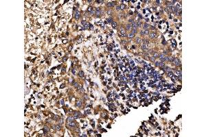 IHC analysis of Calnexin/CANX using anti-Calnexin/CANX antibody (ABIN7602290).