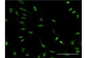 Immunofluorescence of monoclonal antibody to AKT3 on HeLa cell. (AKT3 Antikörper  (AA 100-189))