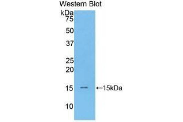 BNP Antikörper  (AA 77-121)