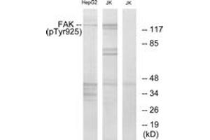 Western blot analysis of extracts from Jurkat and HepG2 cells, using FAK (Phospho-Tyr925) Antibody. (FAK Antikörper  (pTyr925))