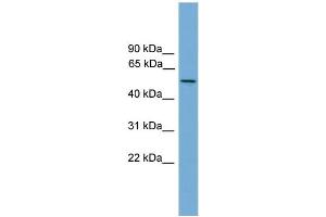 WB Suggested Anti-EFCAB3 Antibody Titration: 0. (EFCAB3 Antikörper  (N-Term))