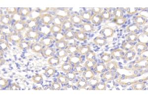 Detection of SPTAN1 in Mouse Kidney Tissue using Polyclonal Antibody to Alpha-Fodrin (SPTAN1) (SPTAN1 Antikörper  (AA 1049-1207))