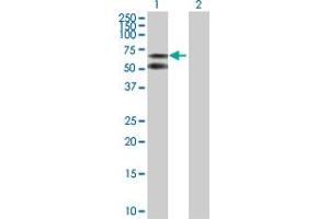 Western Blot analysis of ALB expression in transfected 293T cell line by ALB MaxPab polyclonal antibody. (Albumin Antikörper  (AA 1-609))