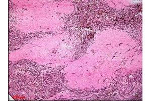 anti-Fibroblasts antibody