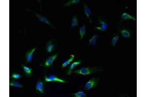 Immunofluorescent analysis of Hela cells using ABIN7145013 at dilution of 1:100 and Alexa Fluor 488-congugated AffiniPure Goat Anti-Rabbit IgG(H+L) (KCNJ1 Antikörper  (AA 178-391))