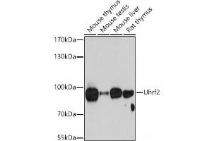 Western blot analysis of extracts of various cell lines using Uhrf2 Polyclonal Antibody at dilution of 1:1000. (UHRF2 Antikörper)