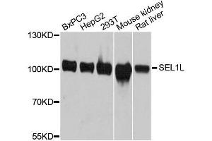 SEL1L Antikörper  (AA 22-190)