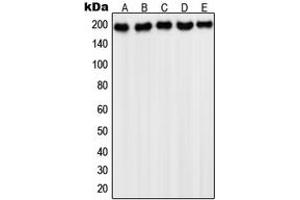 Western blot analysis of PDGFR alpha expression in HepG2 (A), NIH3T3 (B), Saos2 (C), HeLa (D), A431 (E) whole cell lysates. (PDGFRA Antikörper  (C-Term))