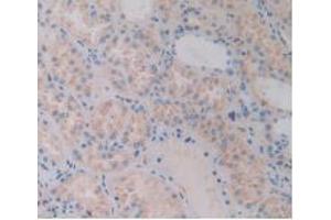 IHC-P analysis of Human Kidney Tissue, with DAB staining. (FLNC Antikörper  (AA 17-259))