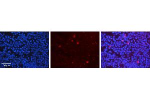 Rabbit Anti-CRKL Antibody Catalog Number: ARP30524_P050 Formalin Fixed Paraffin Embedded Tissue: Human Lymph Node Tissue Observed Staining: Plasma membrane, Cytoplasm Primary Antibody Concentration: 1:100 Other Working Concentrations: 1:600 Secondary Antibody: Donkey anti-Rabbit-Cy3 Secondary Antibody Concentration: 1:200 Magnification: 20X Exposure Time: 0. (CrkL Antikörper  (Middle Region))