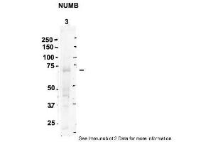 Sample Type: 3. (NUMB Antikörper  (C-Term))