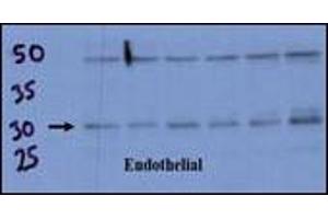 Endothelial cell lysate transferred to membrane was incubated with primary antibody at a 1:500 dilution in 2% BSA in TBST at 4deg C overnight. (RCAN1 Antikörper  (C-Term))