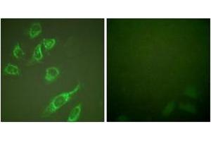 Immunofluorescence analysis of HeLa cells treated with PMA 125ng/ml 30', using 14-3-3 zeta (Phospho-Ser58) Antibody. (14-3-3 zeta Antikörper  (pSer58))