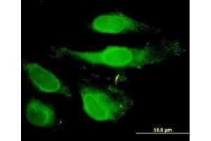 Image no. 3 for anti-Peroxiredoxin 2 (PRDX2) (AA 1-199) antibody (ABIN598967) (Peroxiredoxin 2 Antikörper  (AA 1-199))