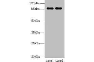 Western blot All lanes: VWA5A antibody at 1 μg/mL Lane 1: A549 whole cell lysate Lane 2: MCF-7 whole cell lysate Secondary Goat polyclonal to rabbit IgG at 1/10000 dilution Predicted band size: 87, 48, 46, 30 kDa Observed band size: 87 kDa (VWA5A Antikörper  (AA 1-415))