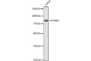 Western blot analysis of extracts of Jurkat cells, using FOXK2 antibody (ABIN7267238) at 1:1000 dilution. (Forkhead Box K2 Antikörper  (AA 511-660))