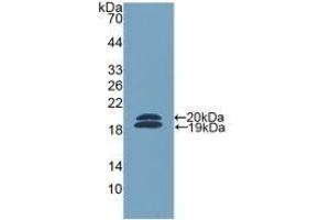 Detection of Recombinant FCN2, Mouse using Polyclonal Antibody to Ficolin 2 (FCN2) (Ficolin 2 Antikörper  (AA 97-254))