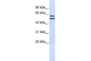 WB Suggested Anti-PIGQ Antibody Titration:  0. (PIGQ Antikörper  (N-Term))