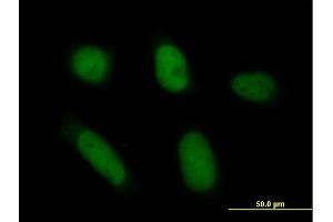 Immunofluorescence of purified MaxPab antibody to ANXA5 on HeLa cell. (Annexin V Antikörper  (AA 1-320))