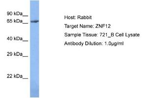 Host: Rabbit Target Name: ZNF12 Sample Type: 721_B Whole Cell lysates Antibody Dilution: 1. (ZNF12 Antikörper  (N-Term))