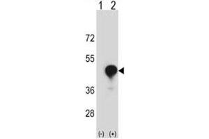 Western blot analysis of CD1c antibody and 293 cell lysate (2 ug/lane) either nontransfected (Lane 1) or transiently transfected (2) with the CD1C gene. (CD1c Antikörper  (AA 226-253))