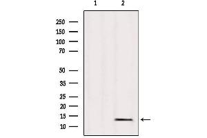 Western blot analysis of extracts from Mouse heart, using L36mt Antibody. (MRPL36 Antikörper  (Internal Region))