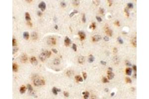 Immunohistochemical staining of mouse brain cells with AP3M1 polyclonal antibody  at 5 ug/mL. (AP3M1 Antikörper  (C-Term))