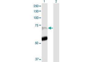 Western Blotting (WB) image for anti-Peptidyl Arginine Deiminase, Type IV (PADI4) (AA 1-663) antibody (ABIN525271)