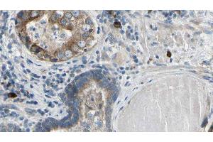 ABIN6279398 at 1/100 staining Human prostate tissue by IHC-P. (RNF41 Antikörper  (Internal Region))
