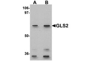 Western blot analysis of GLS2 in rat kidney tissue lysate with GLS2 antibody at (A) 0. (GLS2 Antikörper  (Center))
