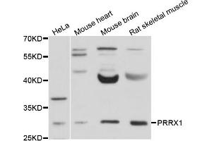 Western blot analysis of extracts of various cell lines, using PRRX1 antibody (ABIN4904876) at 1:1000 dilution. (PRRX1 Antikörper)