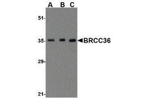 Western Blotting (WB) image for anti-BRCA1/BRCA2-Containing Complex, Subunit 3 (BRCC3) (N-Term) antibody (ABIN2477712) (BRCC3 Antikörper  (N-Term))