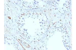 Formalin-fixed, paraffin-embedded human Testis stained with Wilm's Tumor Mouse Monoclonal Antibody (6F-H2).