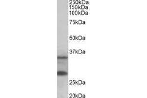 Image no. 1 for anti-U6 SnRNA Biogenesis 1 (USB1) (AA 154-167) antibody (ABIN1100335) (C16orf57 Antikörper  (AA 154-167))