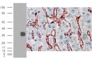 Immunohistochemistry (IHC) image for anti-Fc gamma RII (CD32) (C-Term) antibody (ABIN2465516) (Fc gamma RII (CD32) (C-Term) Antikörper)