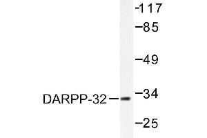 Image no. 1 for anti-Protein Phosphatase 1, Regulatory (Inhibitor) Subunit 1B (PPP1R1B) antibody (ABIN271882) (DARPP32 Antikörper)