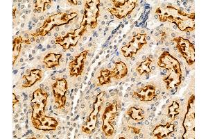 ABIN6264101 and ABIN6269031 at 1/100 staining Rat kidney tissue by IHC-P.