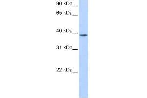 WB Suggested Anti-NUDT13 Antibody Titration:  0. (NUDT13 Antikörper  (N-Term))