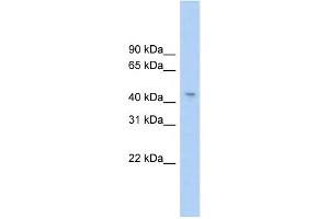 WB Suggested Anti-RG9MTD1 Antibody Titration:  0. (RG9MTD1 Antikörper  (Middle Region))