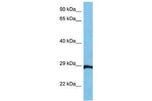 Host:  Mouse  Target Name:  GTF2F2  Sample Tissue:  Mouse Small Intestine  Antibody Dilution:  1ug/ml (GTF2F2 Antikörper  (Middle Region))