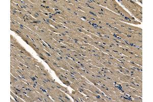 ABIN6263014 and ABIN6278668 at 1/100 staining rat heart tissue by IHC-P. (LSM1 Antikörper  (N-Term))