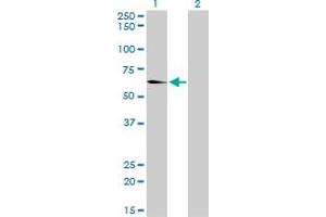 Western Blot analysis of EHD2 expression in transfected 293T cell line by EHD2 monoclonal antibody (M01), clone 2D8. (EHD2 Antikörper  (AA 365-427))