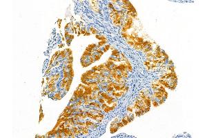 ABIN6258641 and ABIN6275365 at 1/100 staining Rat ovary tissue by IHC-P.