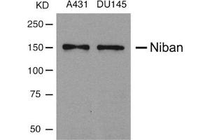 Western blot analysis of extracts from A431 and DU145 cells using Niban Antibody. (Niban Antikörper)