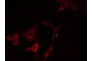 ABIN6274724 staining HeLa cells by IF/ICC. (HSD3B7 Antikörper  (Internal Region))