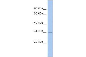 Host: Rabbit Target Name: GLYATL3 Sample Type: Fetal Brain lysates Antibody Dilution: 1. (GLYATL3 Antikörper  (C-Term))