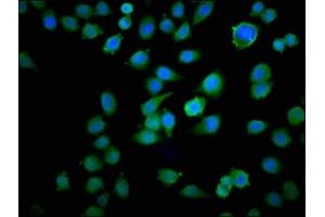Immunofluorescence staining of Hela cells with ABIN7172906 at 1:100, counter-stained with DAPI. (TPT1 Antikörper  (AA 1-172))
